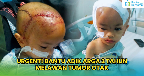 URGENT! Bantu Adik Arga 2 Tahun Melawan Tumor Otak