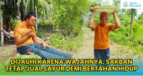 Dijauhi Karena Wajahnya, Sakban Tetap Jual Sayur Demi Bertahan Hidup