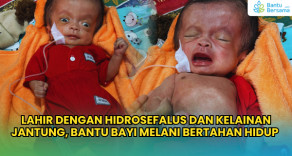 Lahir Hidrosefalus Dan Kelainan Jantung, Bantu Bayi Melani Bertahan Hidup