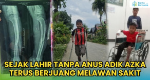 Sejak Lahir Tanpa Anus Adik Azka Terus Berjuang Melawan Sakit