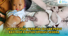 URGENT! Usus Terburai Di Luar Perut, Bayi Adifa Butuh Operasi Segera