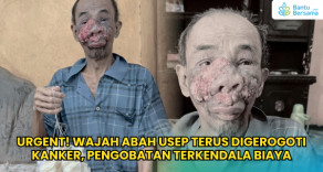 URGENT! Wajah Abah Usep Terus Digerogoti Kanker, Pengobatan Terkendala Biaya